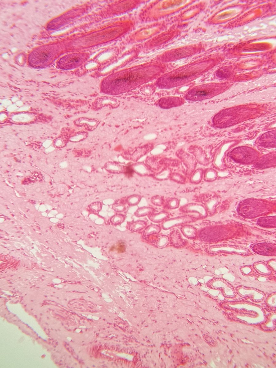 justran29's tweet image. Suka dikit 🤏