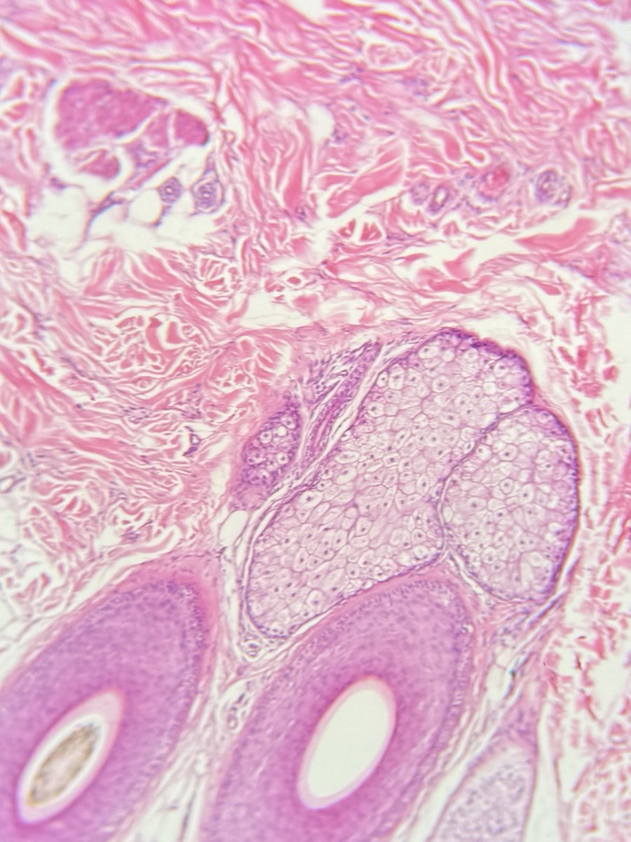 justran29's tweet image. Suka dikit 🤏