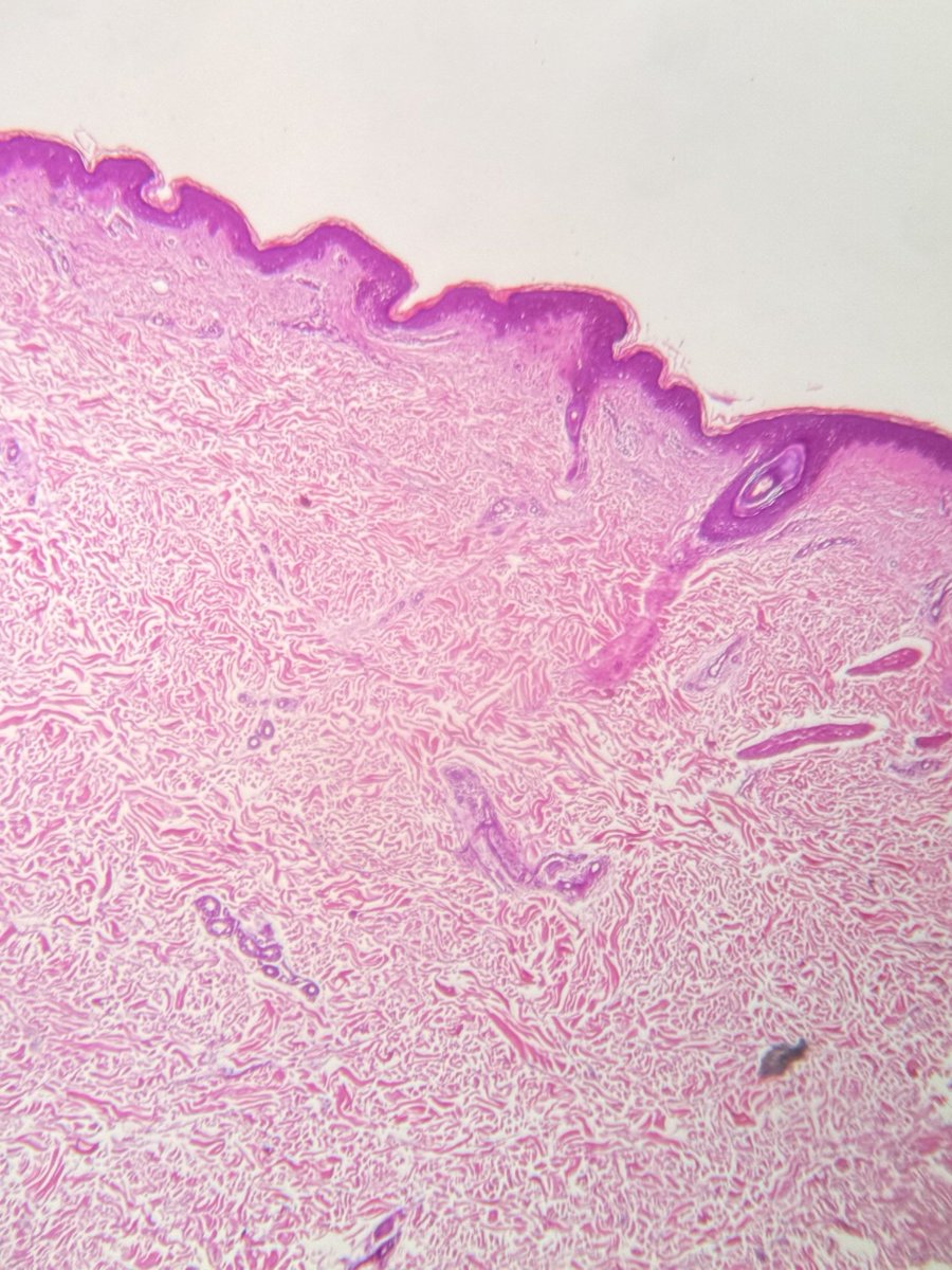 justran29's tweet image. Suka dikit 🤏