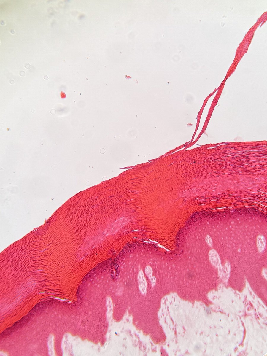 justran29's tweet image. Suka dikit 🤏