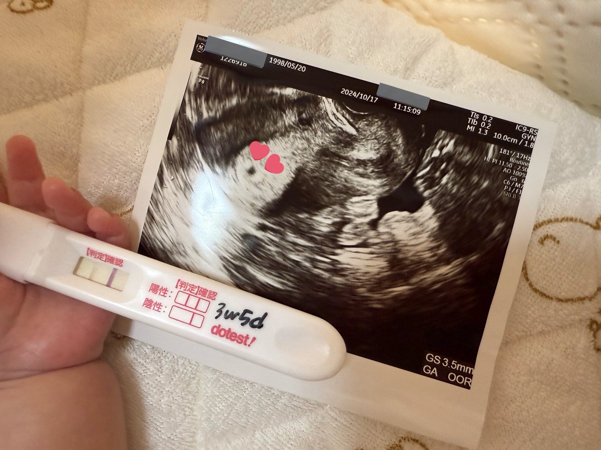 M_0520H's tweet photo. 1年前の今日､妊娠がわかった日🤰🫶🏻💕 https://t.co/YUP7KzfaeJ