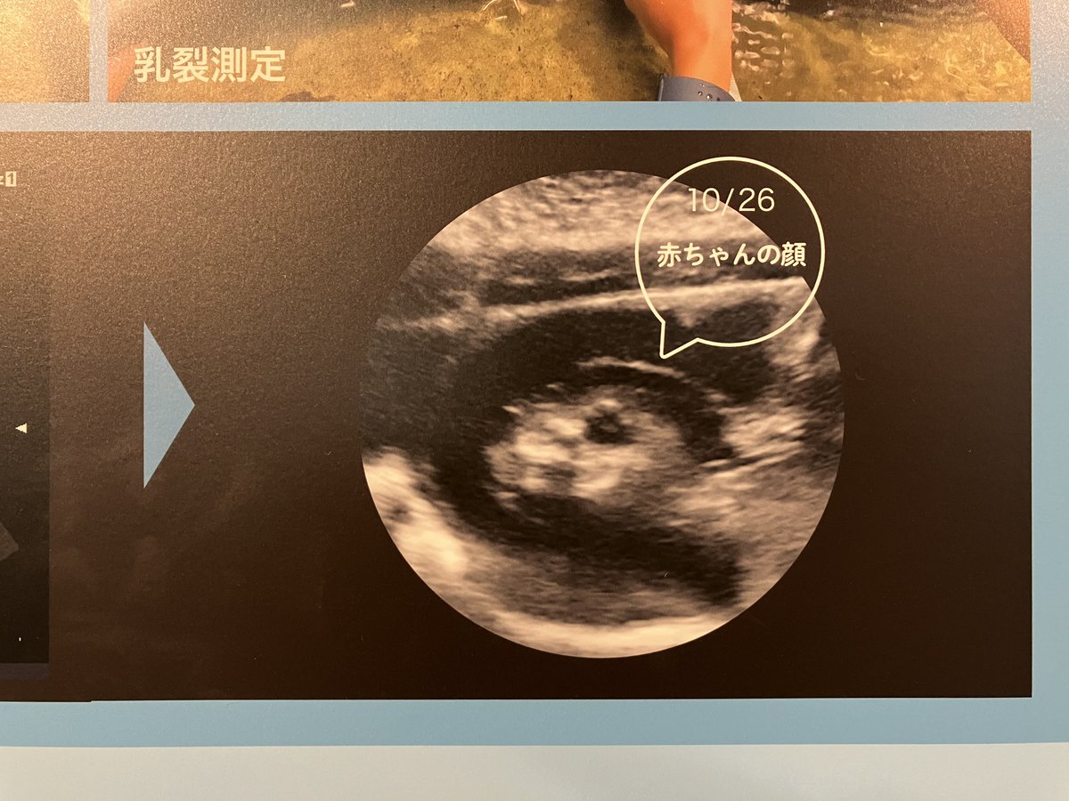 hirootsubo's tweet image. えのすい、「アザラシ繁殖の取り組み」のパネル展示が復活してて嬉しかった。胎内の、生まれる前なのに既にココアの顔した写真がかわいい🦭

#ゴマフアザラシ
#新江ノ島水族館