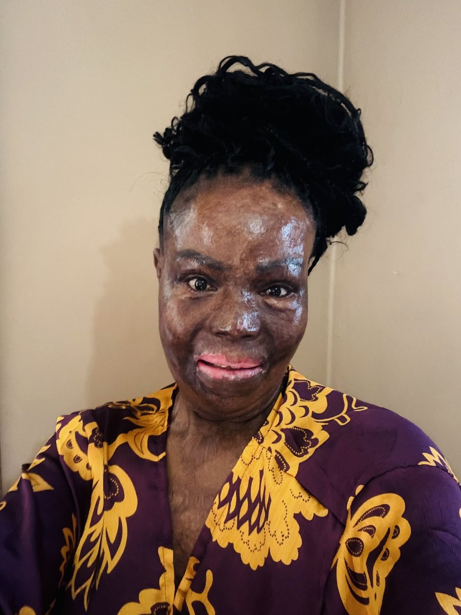 Misst_Thembs's tweet image. From Victim to victor 🤍
Scars to Stars
Impossible to I’m Possible 

• From Pain to Power
 • From Wounds to Wisdom
 • From Broken to Brave
 • From Fear to Fierce
 • From Tears to Triumph
 • From Ashes to Beauty
 • From Survivor to Warrior
 • From Hurt to Healed
 • From…