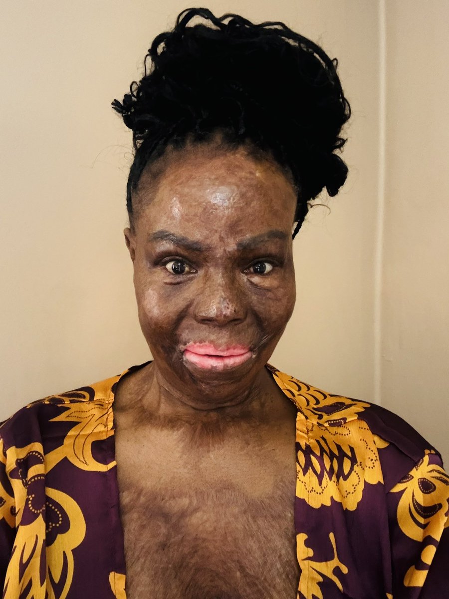 Misst_Thembs's tweet image. From Victim to victor 🤍
Scars to Stars
Impossible to I’m Possible 

• From Pain to Power
 • From Wounds to Wisdom
 • From Broken to Brave
 • From Fear to Fierce
 • From Tears to Triumph
 • From Ashes to Beauty
 • From Survivor to Warrior
 • From Hurt to Healed
 • From…