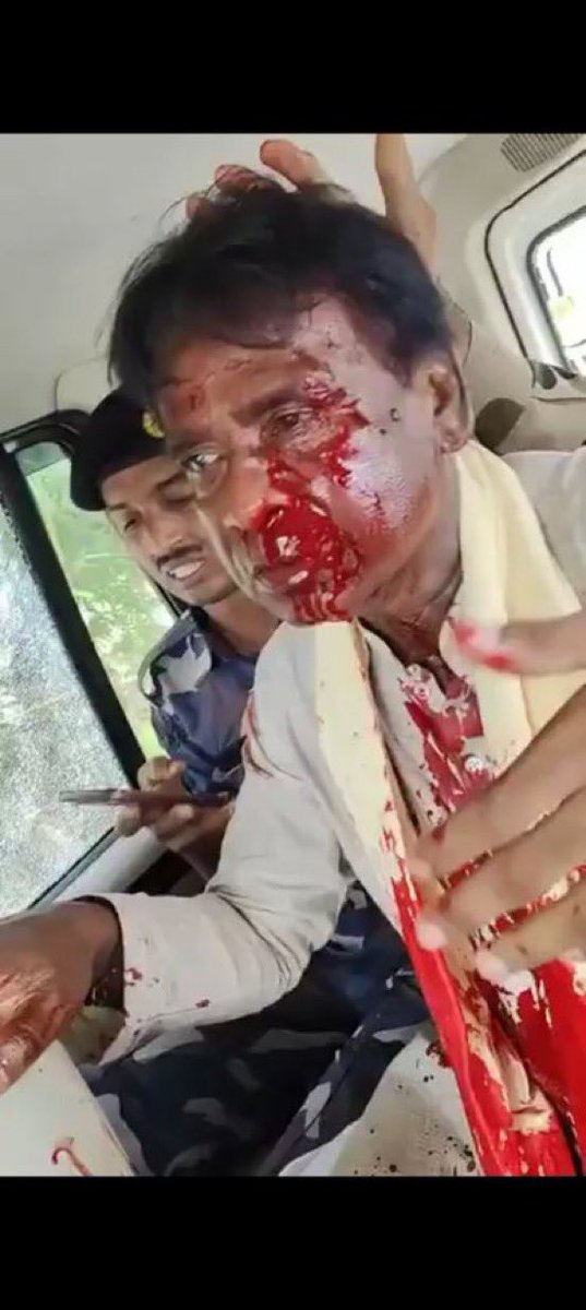 MithilaWaala's tweet image. Yesterday #KhagenMurmu, a Santhali Tribal &amp;amp; sitting BJP MP was attacked in West Bengal.

His skull was broken &amp;amp; is currently hanging between life and death

No ST-SC activists spoke for him just because he is from BJP

All busy proving Buddhist #BRGavai a dalit and how attack on…