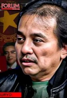 Kira kira mikirin apa Om Suryo kok rontok rambutnya itu ya  ?