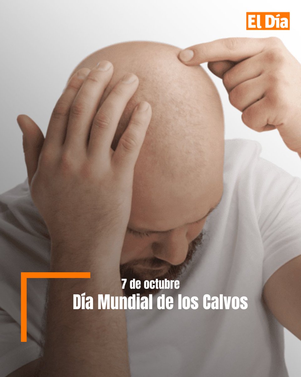 ElDia_do's tweet photo. Lo que antes era motivo de burla o complejo se ha convertido en una marca de orgullo y estilo. Cada 7 de octubre, el Día Mundial de los Calvos rinde homenaje a quienes lucen su cabeza rapada o sin cabello con naturalidad.

# #DíaMundialDeLosCalvos #Calvos #periódicoeldía https://t.co/2OTGwqG6qh