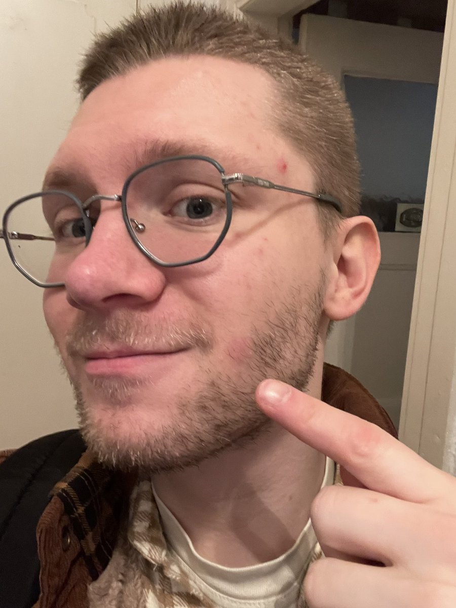 Bekomme ich gerade den größten Pickel der Geschichte? Wahrscheinlich. Das passiert wenn man sich denkt „Ach komm, ich kaufe mal das andere Waschpulver“ hab seitdem so viele Pickel einfach 😭😭