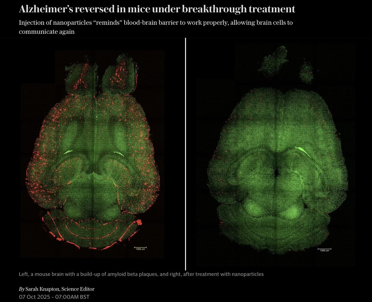 Some interesting breakthroughs happening for Alzheimer’s disease.

Sad to think that the speed of this sort of progress usually means it unlikely to help anyone suffering it today.

Hopes of a cure in the future though.