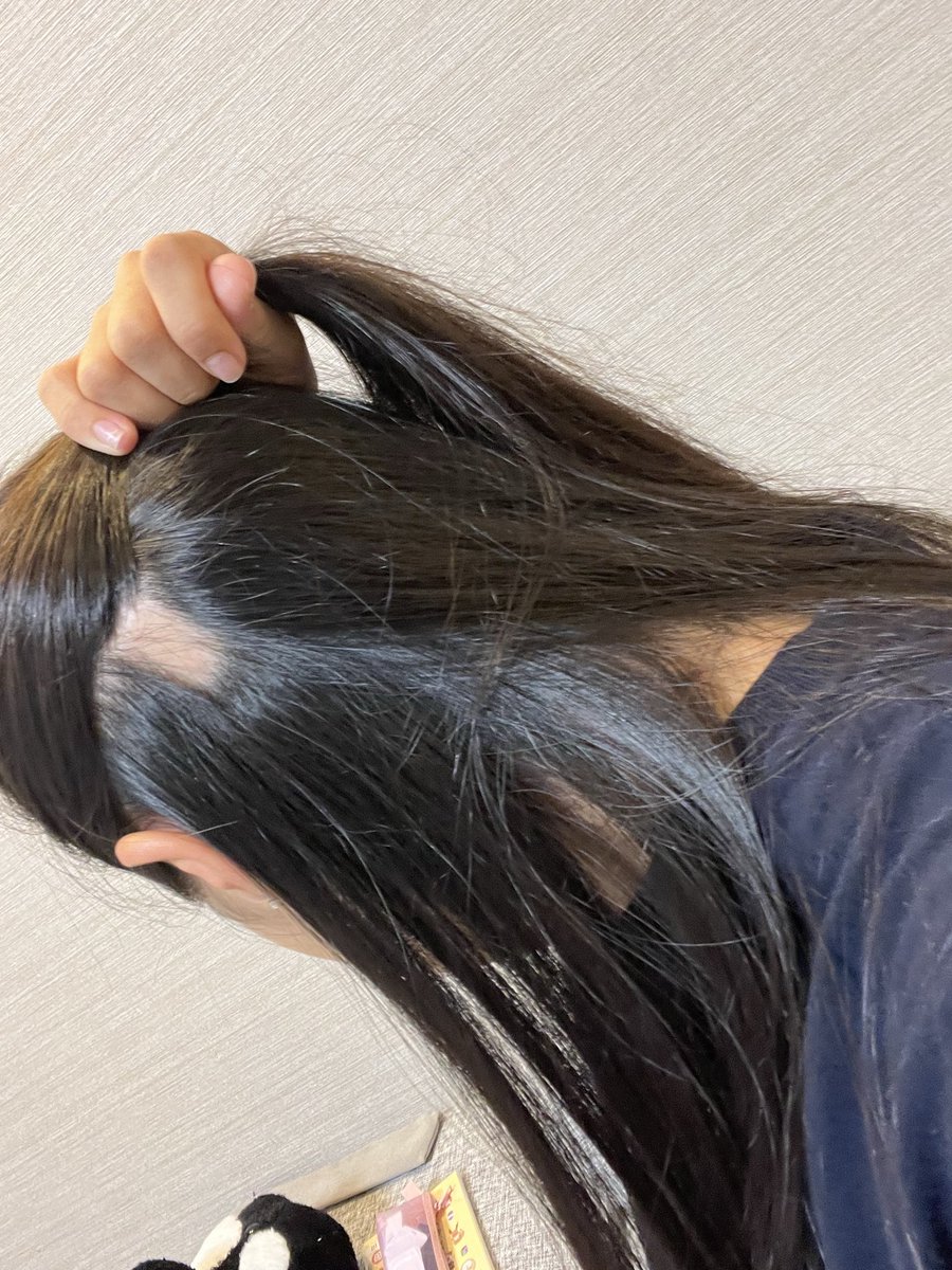 ハゲたんだけどwww