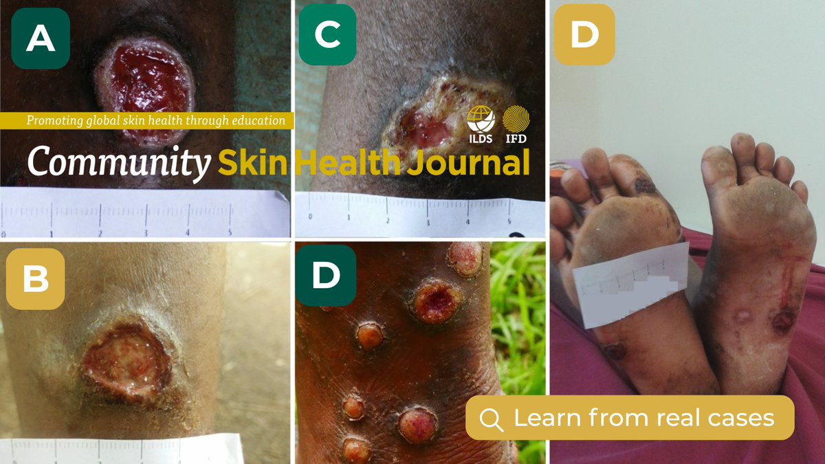 International Foundation for Dermatology tweet media