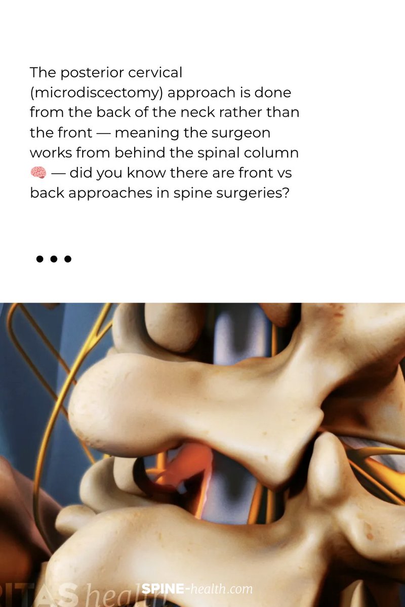 Spine-health tweet media
