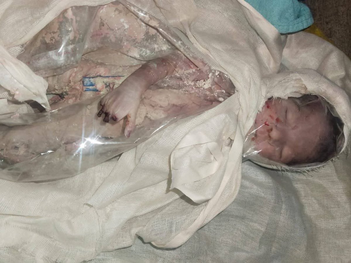 आदिवासियों की जान सस्ती है? 

CM मोहन यादव जी आदिवासी समाज पूछ रहा है
बदनावर आए, पर आदिवासी बेटी के घर नहीं गए
MY अस्पताल गए,पर “चूहा कांड” में आदिवासी बच्ची के लिए एक शब्द तक नहीं कहा?

क्या आदिवासियों के दर्द के लिए आपकी संवेदना खत्म हो गई है?
<a href="/CMMadhyaPradesh/">Chief Minister, MP</a> 
<a href="/rshuklabjp/">Rajendra Shukla</a>