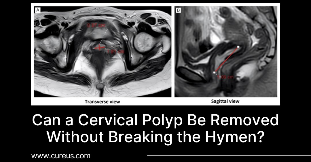 Cureus Dermatology tweet media
