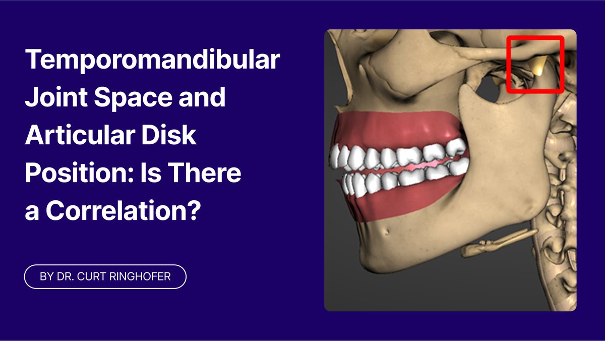 Could TMJ instability be the silent reason your restorations fail? 

Up to 30% of pain-free patients show disk displacement—maybe more in Class II cases!

Dr. Curt Ringhofer breaks it down in our latest Spear Digest article. 
👉 bit.ly/4gSaU6Q
