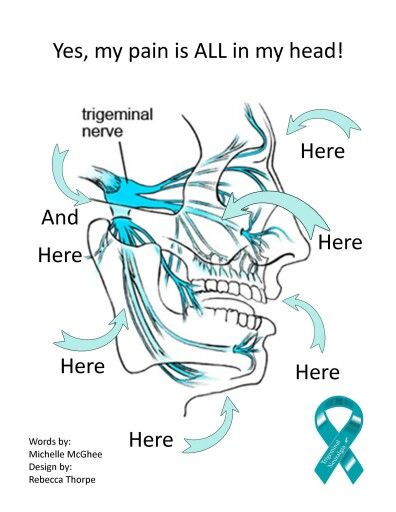 DomandoAlLobo's tweet image. Y @leo_veritas tenía razón. Será la típica pq estoy respondiendo al tratamiento adecuado en dosis adecuadas🙏
313 #NeuralgiaDelTrigémino: el tridente de la cara tenía nombre (II) domandoallobo.blogspot.com/2024/12/313-ne…
#7octubre #Diainternacionalneuralgiatrigemino #trigeminalneuralgiaawarenesday