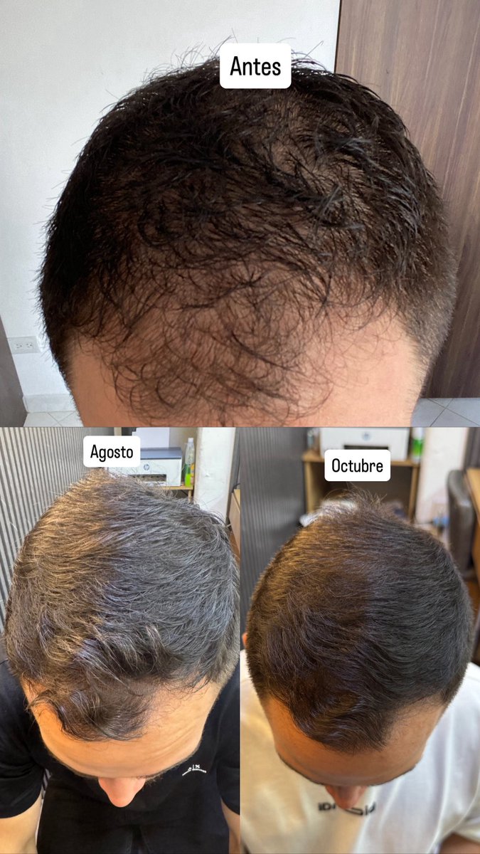 FITO🐆 tweet media