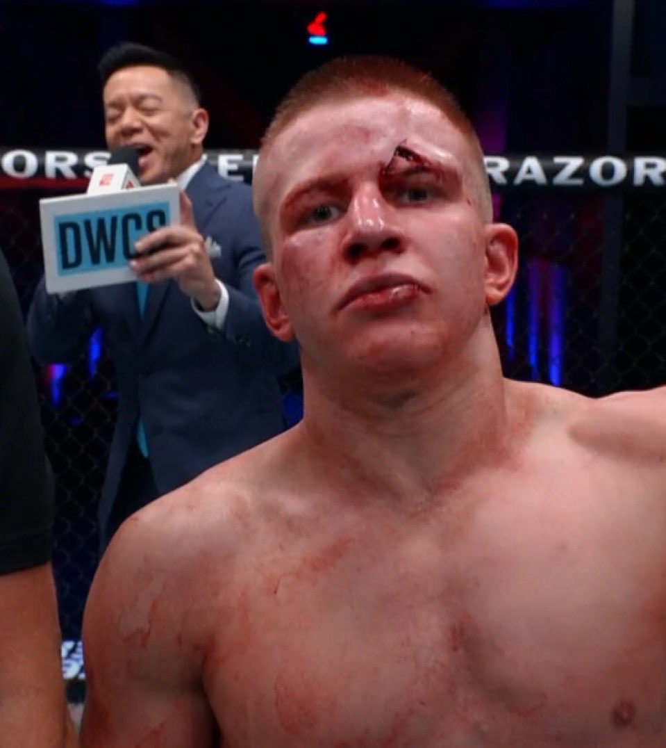 bolt_up21's tweet image. FIGHT OF THE YEAR

UFC

HOW FUCKING GOOD ARE WE?!

#DWCSWeek9