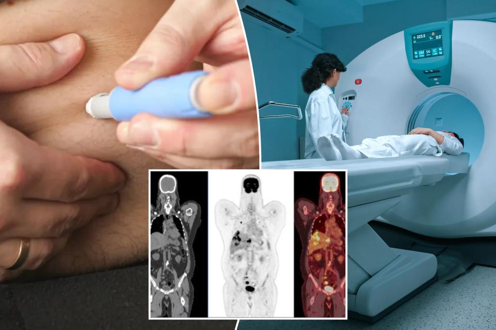 nypost's tweet photo. ‘Unusual’ new side effect of drugs like Ozempic becoming ‘increasingly common’ https://t.co/hnULBNIIWu https://t.co/F3Pc9IHhu8