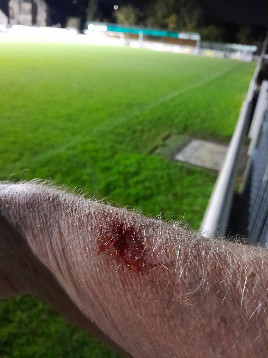 Grateful thanks to the slobs at <a href="/BelperTownFC/">𝗕𝗲𝗹𝗽𝗲𝗿 𝗧𝗼𝘄𝗻 | 𝟣𝟪𝟪𝟥</a> who seem incapable of spotting the large blue bins and the black wheelie bins with the yellow tops .. someone has to clear up your 💩 and this can sometimes be the result ... think on ..