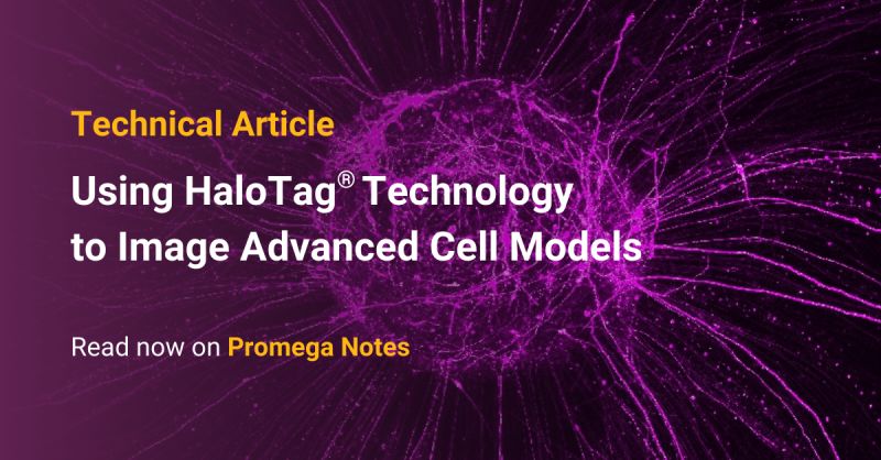 PromegaAU's tweet photo. 🔖🔬 Article | Imaging complex 3D models like cerebral spheroids can be challenging, with issues such as signal loss and high background noise. 

Learn how Janelia Fluor® HaloTag® Ligands overcome imaging challenges in 3D models: https://t.co/eOTmVY0ie7 https://t.co/C3ojlCtzQG