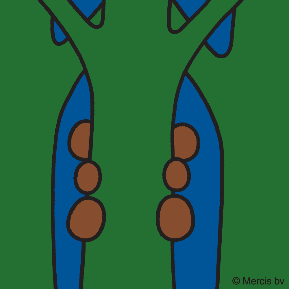 miffy_japan's tweet photo. 10/8は　木の日 🌳

さて　クイズです

ブルーナさんの　木の　イラストに
くっついている　ちゃいろい　まるは
いったい　なんだ？

A むし
B きのこ
C ストロープワッフル
D その他

アンケートで　こたえてね👇 https://t.co/eTNRcapIhc