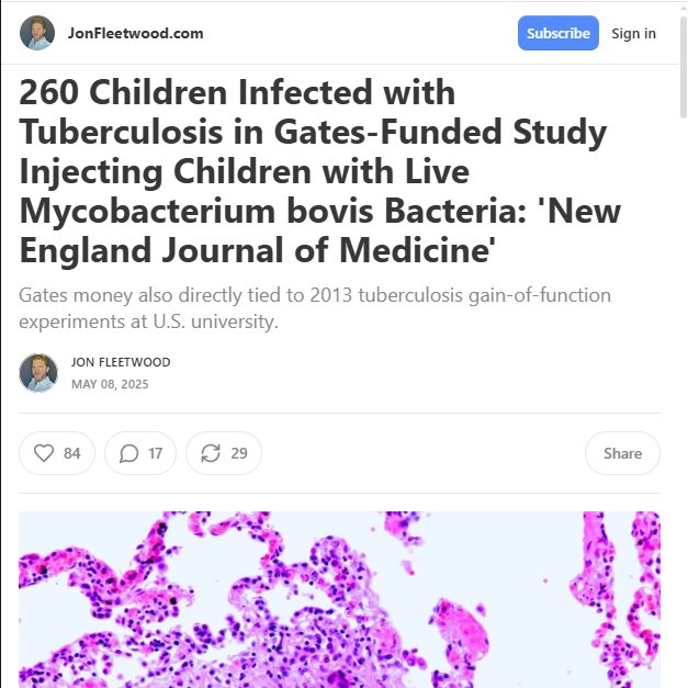 KalergiPlanNevr's tweet image. Jews use our #goyim children as lab rats, and in 2013 Bill Gates infected them with tuberculosis for fun and money.

#Weimarproblems