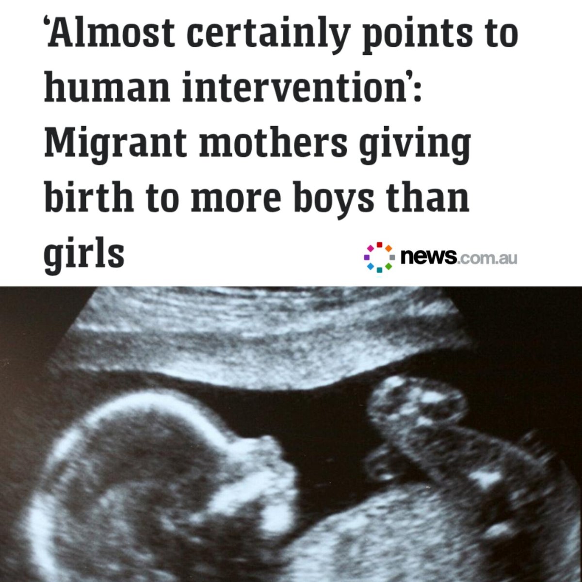 New research has uncovered shocking evidence of sex-selective abortion right here in Australia.

An analysis of 2.1 million births in NSW and WA found that while Australian born mothers had a natural balance of 105 boys for every 100 girls, the ratios were vastly different for: