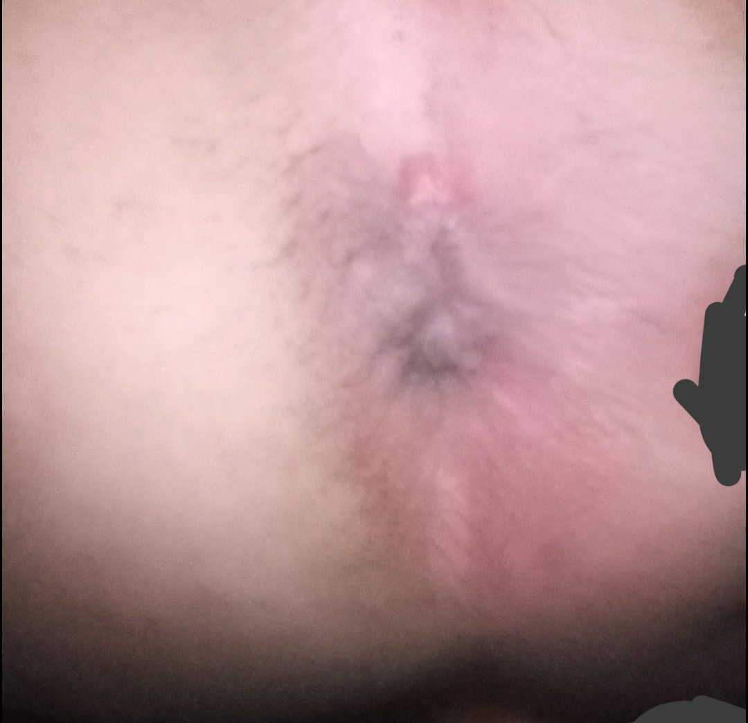 Que ganas de que me la metan y me abran por primera vez, tengo muchas ganas de experimentar manden mensaje 😋🤭
También puedo ser activo si desean 😋🤭