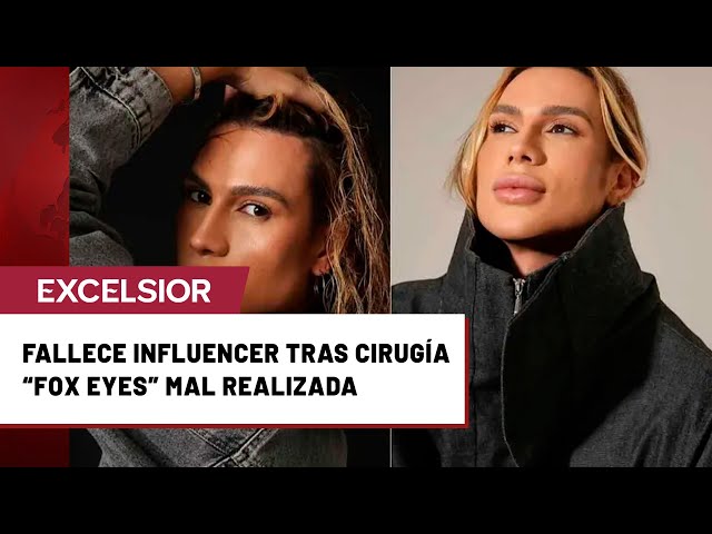 twuai_'s tweet image. El influencer brasileño Junior Dutra fallece por complicaciones tras una cirugía estética de &quot;fox eyes&quot; realizada por un dentista sin licencia. 🇧🇷⚠️ #JuniorDutra #FoxEyes #CirugiaEstetica
twuai.com/search/4FUE0Hj…