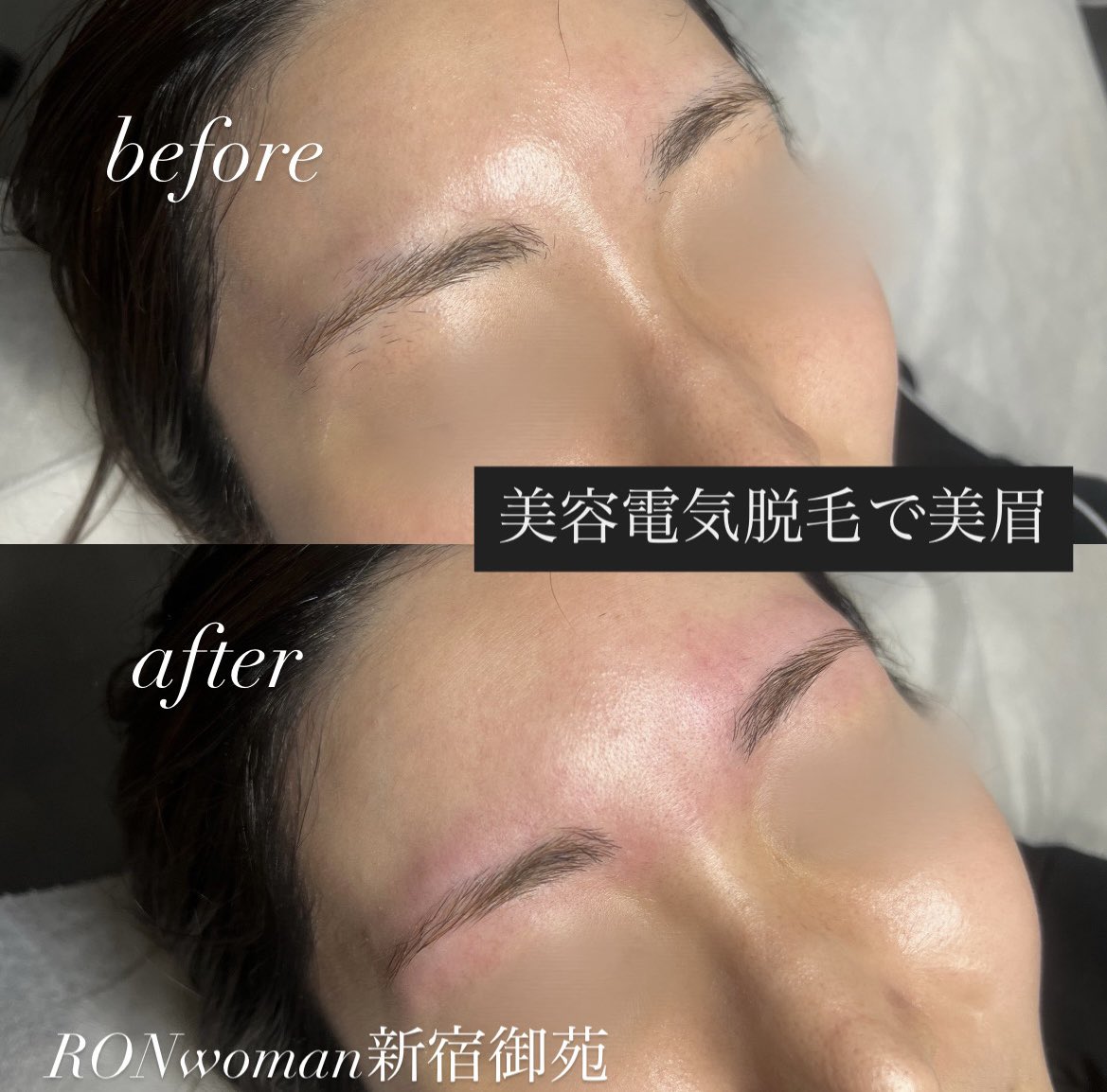 昨日もご来店ありがとうございました😊

美眉に仕上がりました✨

＃美容電気脱毛
＃眉毛脱毛