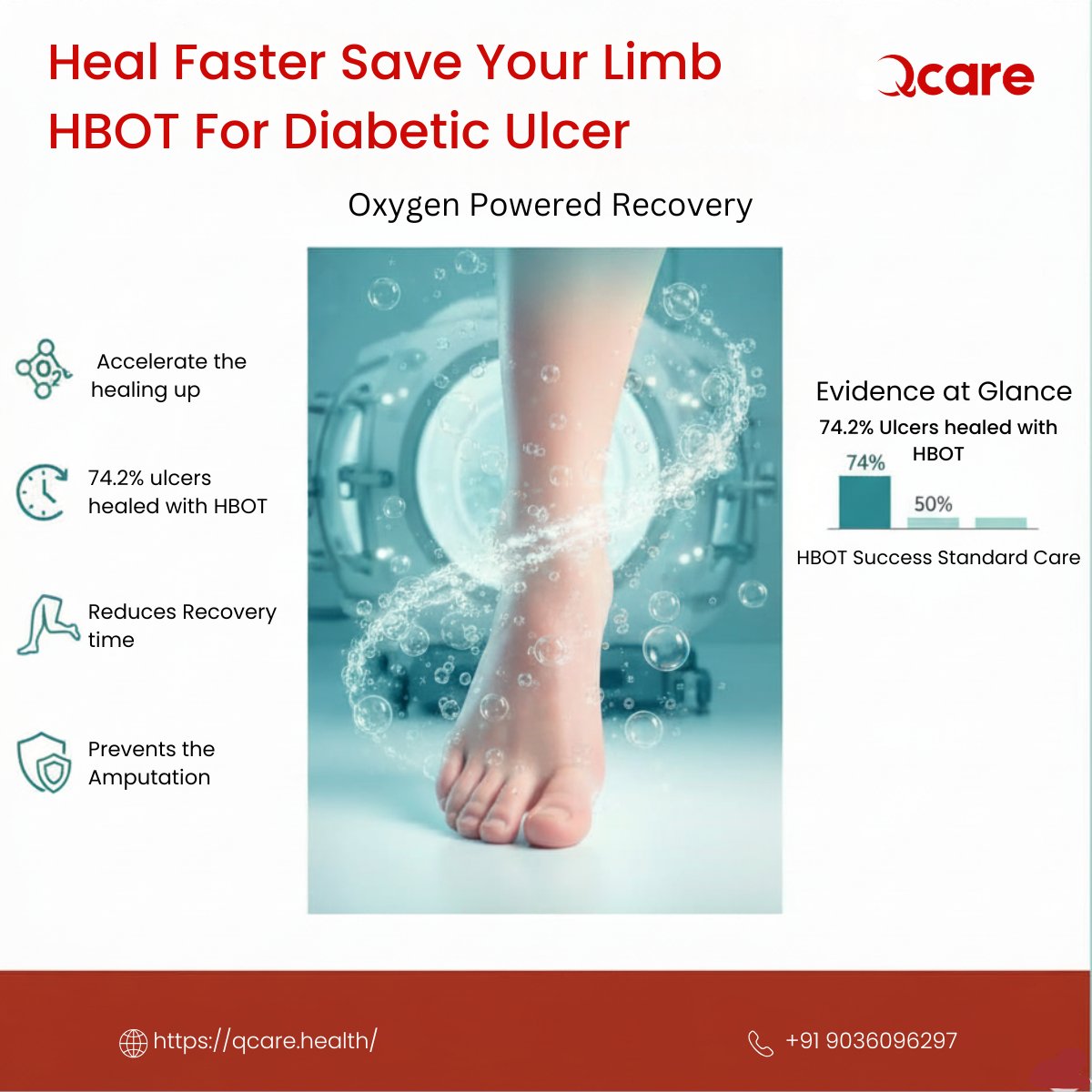Qcare_Health's tweet photo. Don’t let diabetic ulcers take your step away heal faster, safer, and stronger with HBOT at QCare. 
74.2% success rate. Reduced recovery time. Fewer amputations.
🌐https://t.co/SmSt0cjVLK |📞+91 9036096297
#DiabeticUlcers #HBOT #WoundHealing #SaveYourLimb #QCare #OxygenTherapy https://t.co/fufGQOtlvu