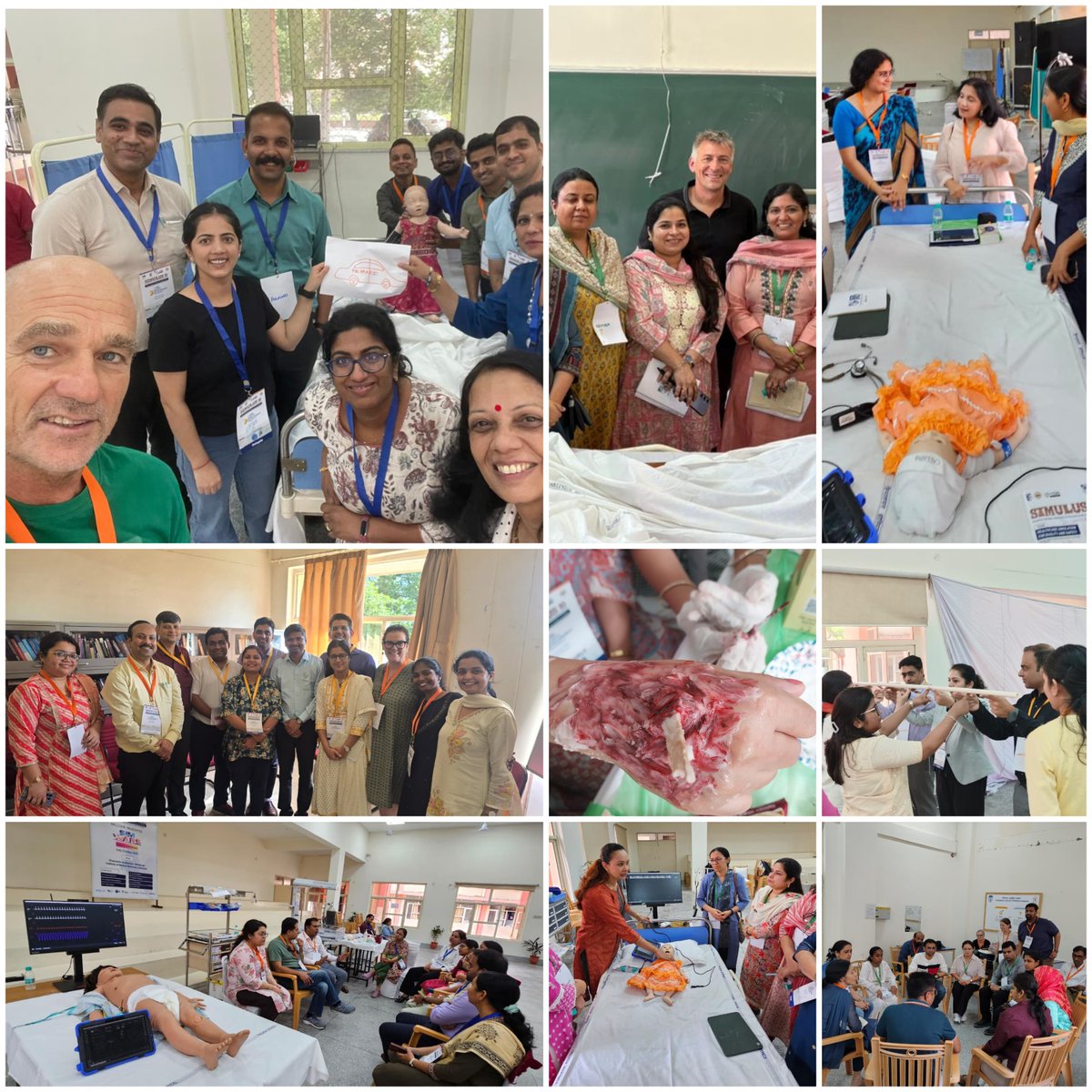 PediSTARSIndia's tweet image. Empowering educators through simulation! 🎓💡The #FDP Workshop at #Simulus10, HIMS Dehradun, brought together passionate faculty to enhance teaching skills and inspire innovation in medical education. 🩺✨ #FacultyDevelopment #MedicalSimulation #Simulus10 #HIMSDehradun #PediSTARS