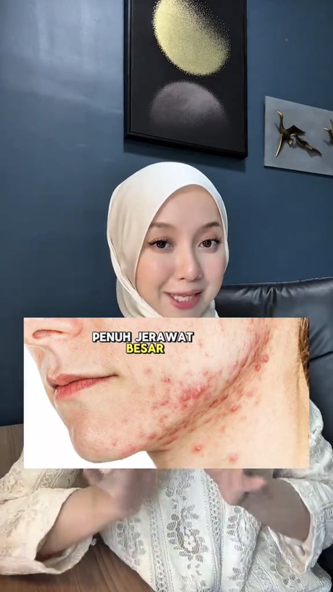 kyumadethings's tweet photo. 25 tahun ke atas dan selalu naik jerawat dekat area dagu, jawline? Ni Dr Wina dah explain kenapa dan cara-cara nak heal this type of breakout.￼ https://t.co/Ddo8tNUJ2m