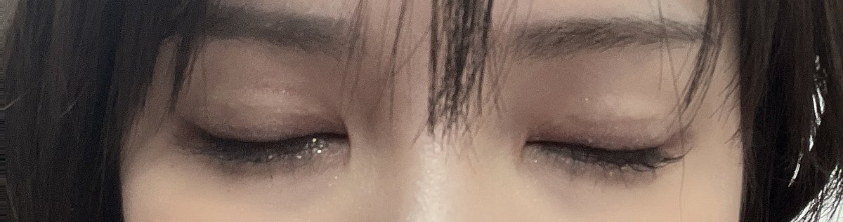 1118_3's tweet photo. 目整形してから1ヶ月経ちました！
自然癒着＋目つき矯正＋目頭切開
担当医はウィ・ソンジェ先生です😋

もうほとんどアザは消えて後は傷跡すこーし残ってるくらい🥺
もともと左右非対称の目やけど左右差整える事で顔の見え方も変わるし、何より化粧が楽しくなる🥰

迷うならやるべし🥰 https://t.co/7DJ8e34PZy