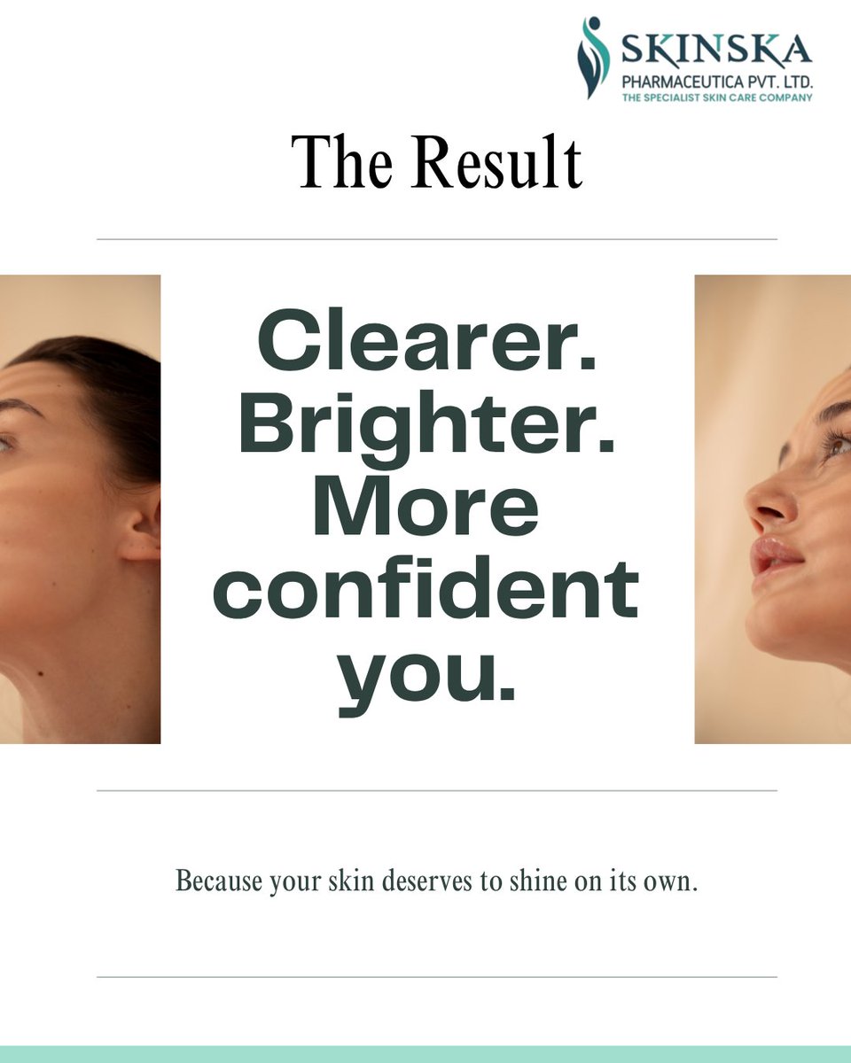 skinskapharma's tweet image. Be confident in your skin, no filters, no holding back. Kojiska Skin Brightening Cream helps reduce pigmentation, fade dark spots, and bring out your natural glow with every use. 🌿✨

Order Your's: skinska.com

#skincareessentials #skinbrightening 
#pigmentationcare