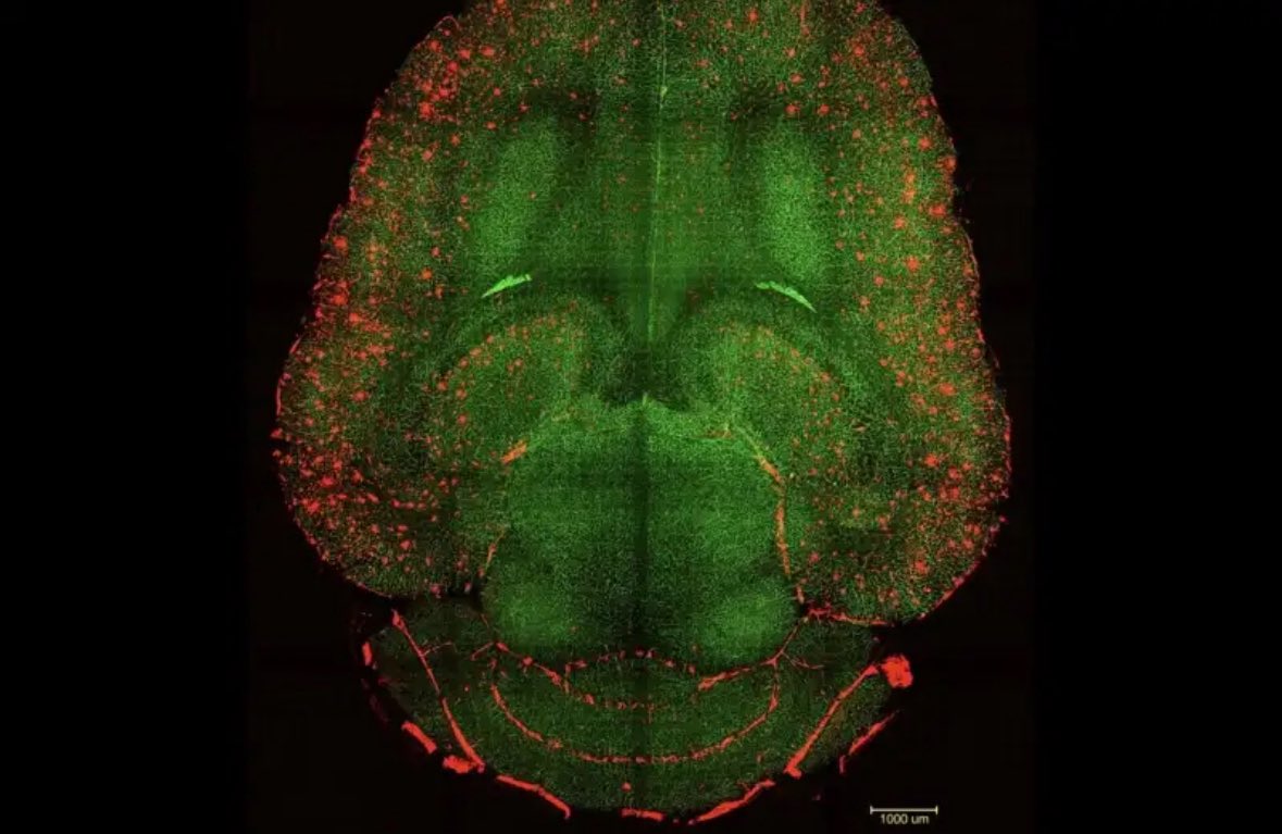 Araştırmacılar Alzheimer hastalığını farelerde tersine çevirmeyi başardı.

Sadece üç doz nanopartikül uygulaması sonrası, fare beynindeki amyloid-β proteini miktarında 1 saat içinde %50–60’lık azalma gözlendi.