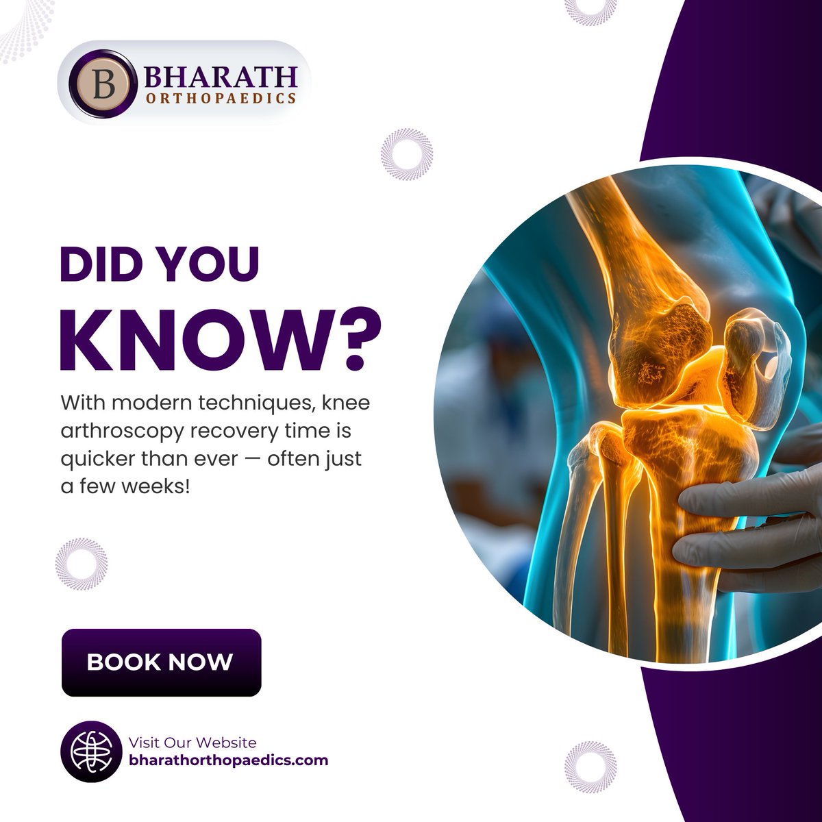 BharathOrtho's tweet image. Did You Know?

With modern techniques, knee arthroscopy recovery time is quicker than ever — often just a few weeks!

Less pain. Smaller scars. Faster return to daily life.

📞 +91 96627 36666 | 🌐 bharathorthopaedics.com
#KneeArthroscopy #QuickRecovery #BackOnYourFeet