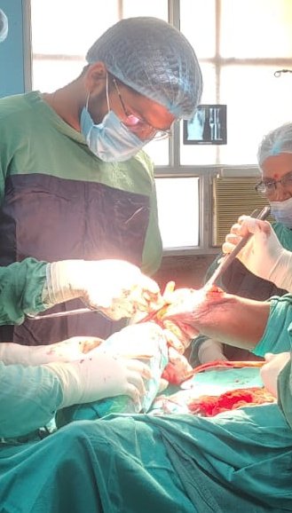 Dr_KD_MS's tweet image. This 14 year old child has malunited tibia (55 Days Old) ORIF with LCDCP plate done today at #PMCH 
#Bihar