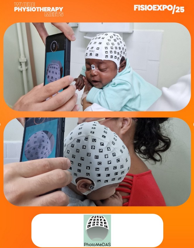 Exponemos en #FISIOEXPO/25 el 24, 25 y 26 Oct.
Visítanos en el Pabellón 8, Stand E8
Presentamos los últimos avances de #PhotoMeDAS <a href="/GIFLE_UPV/">GIFLE UPV</a>
<a href="/CPInnovacion/">CPI - UPV | Ciudad Politécnica de la Innovación</a> <a href="/ccd_upv/">Cooperación al Desarrollo UPV</a> <a href="/UPV/">Universitat Politècnica de València</a>