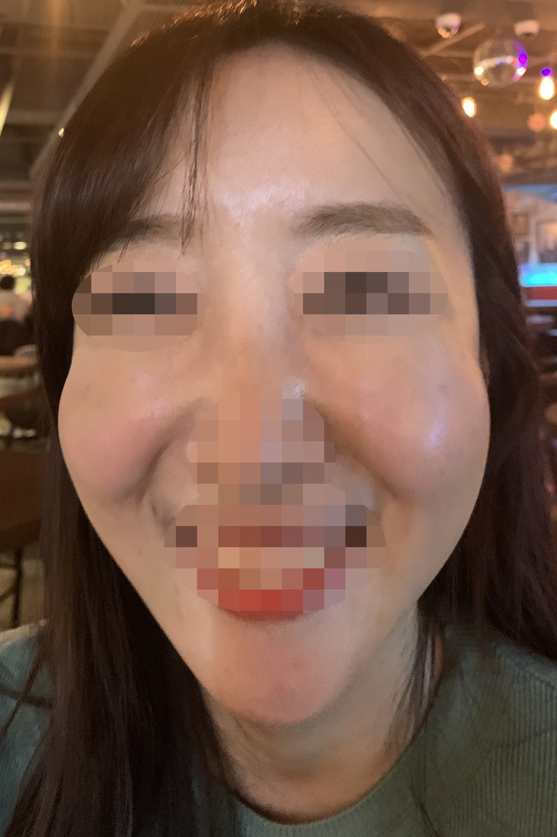 整形OL ロビたん tweet media