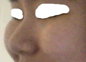 整形OL ロビたん tweet media