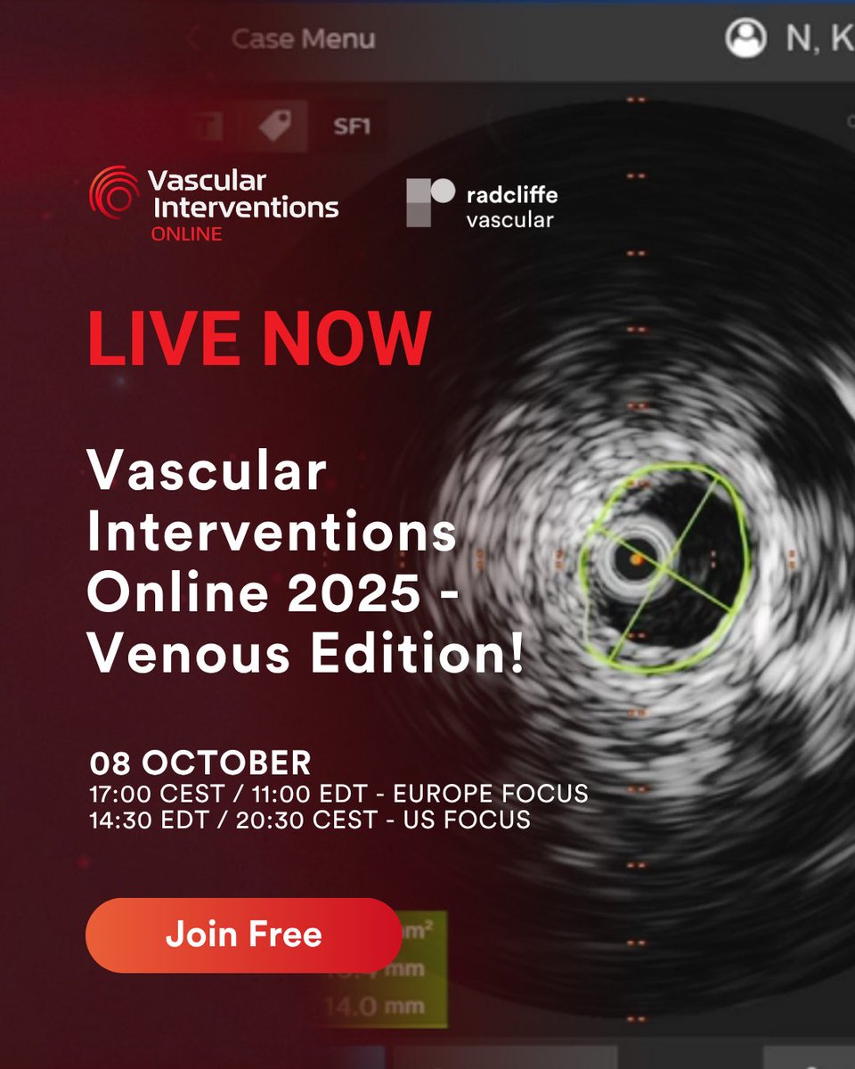 🔴Vascular Interventions Online (#VIO) 2025 – Venous Edition is LIVE!

Join us free now 👉 ow.ly/QEQr50X8A0r

💬 Don’t miss the chance to interact with global experts and learn the latest in venous intervention techniques.

#VIO2025 #VenousCare #Thrombectomy #DVT