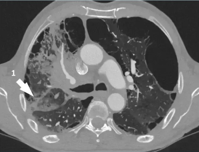 نايل🌙 tweet media
