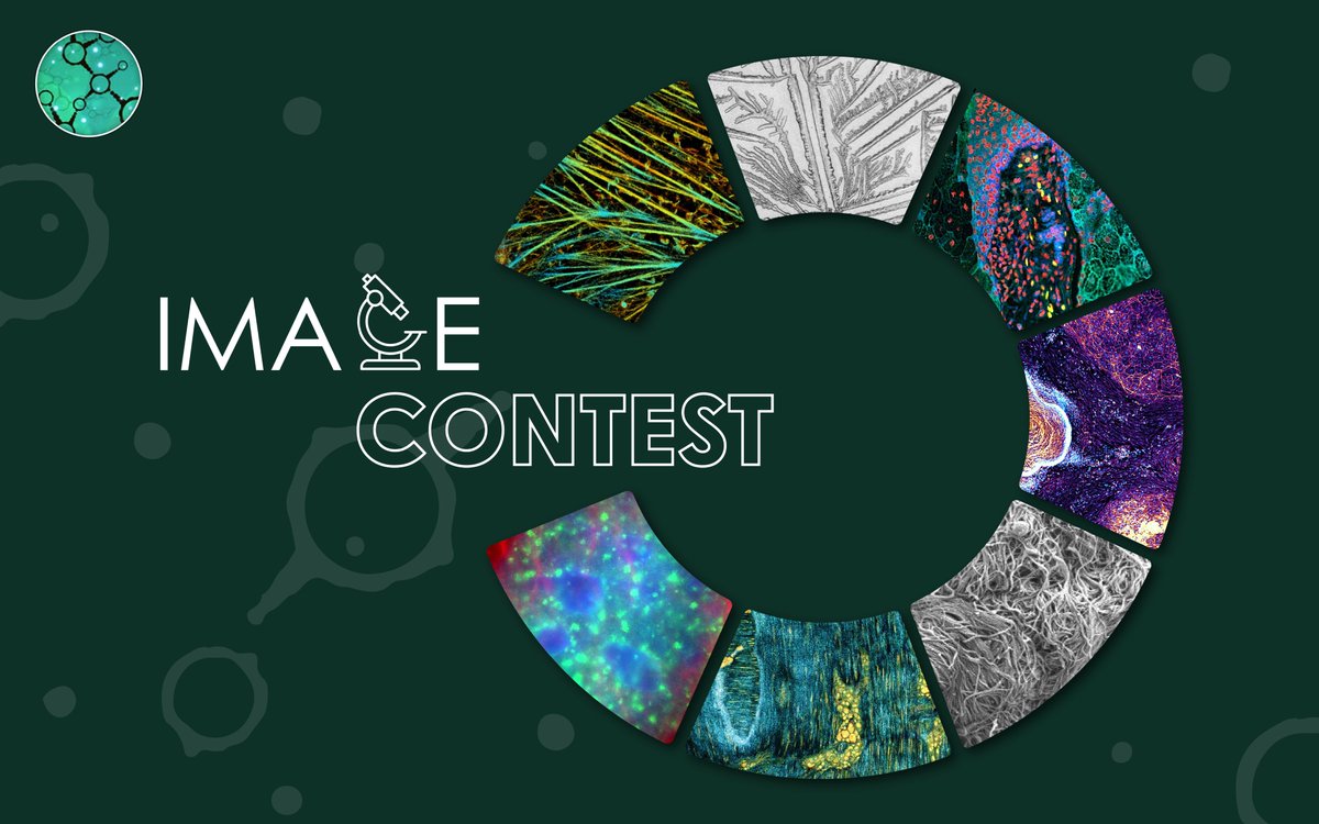 Fr_BioImaging's tweet image. The FBI Image Contest is still open!

You have until November 14th, 2025 to submit your most beautiful #microscopy images! 

🚨 Don’t wait! Submit here 👉 france-bioimaging.org/fbi-special-ev…

We can’t wait to discover your work!