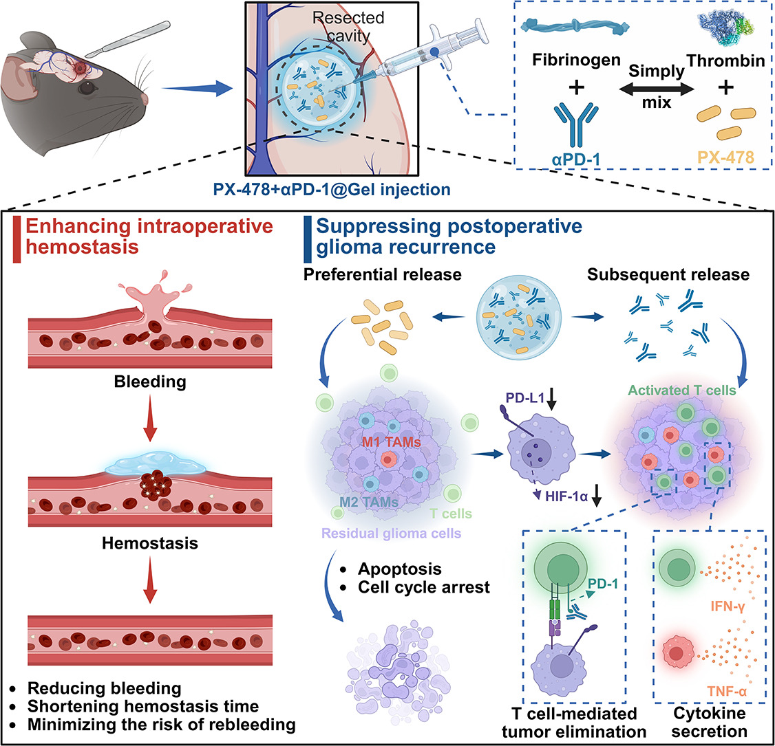 JCRnEDITORS's tweet photo. In situ formed chemo-immunotherapeutic hydrogel for suppression of postoperative glioma recurrence and intraoperative hemostasis.
| Qian Chen, Soochow Univ. |
[50 days' free access]
#FibrinGel #postoperative #glioma
https://t.co/ez60Hi3ws9 https://t.co/HDicywqexN