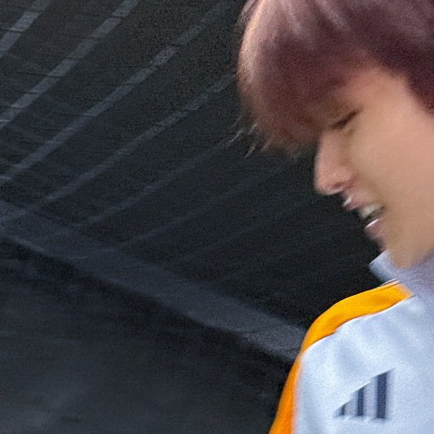 wwwsungchancom's tweet photo. 애굣살,앞볼,앞니
내가쩨일좋아하는거 https://t.co/L2uLRNyWZm