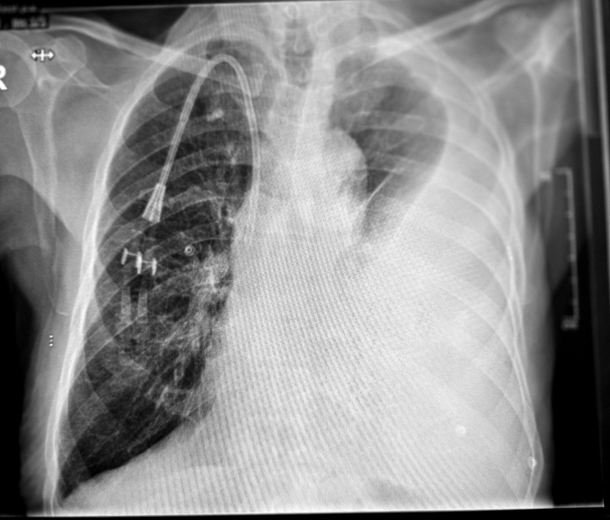 Mastery of Emergency Medicine tweet media