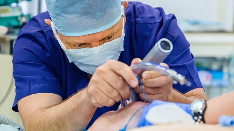 How Does #Anaphylaxis Due to #Neuromuscular #Blockers Affect Future #Anesthesia? The incidence of perioperative anaphylaxis related to neuromuscular blocking agents was 58.1 reactions per 100,000 administrations. medscape.com/viewarticle/ho…