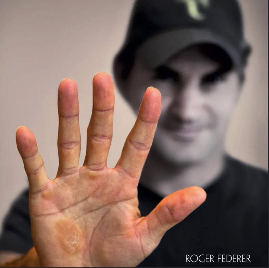 Djoko_UTD's tweet photo. Hands of a Tennis players after playing a Grand Slam match.

 Incredible how much effort top level tennis takes from them 🤯🤯 https://t.co/nin8yiK3iD